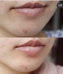 -梵玛西美肌皮肤管理中心