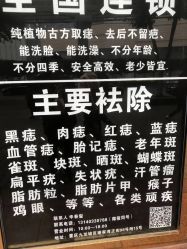-痣缘宫