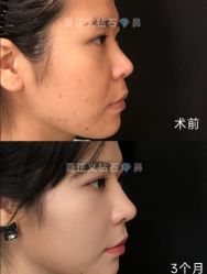 -北京米扬丽格医疗美容·联合丽格鼻整形中心