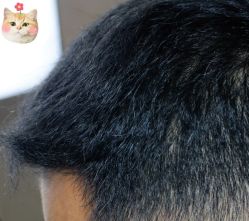 -大麦微针植发丨全国连锁