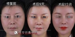 -北京米扬丽格医疗美容·联合丽格鼻整形中心