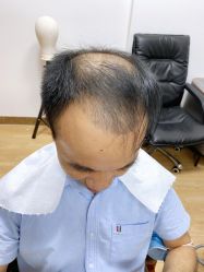 -发饰美男士增发补发假发定制店