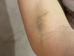 -苏州市立医院(白塔院区)