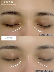 点击看大图 -skin79皮肤管理基站