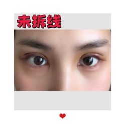 -素美医疗美容·西南眼鼻整形·修复基地
