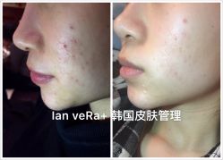 -IRIS韩国皮肤管理中心
