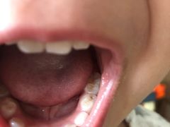 -极橙儿童齿科矫正中心(奥城店)