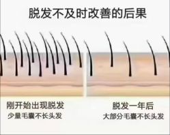 -Bollins波林丝•专研护发中心