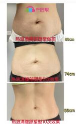 -产后帮产后修复(首城国际店)