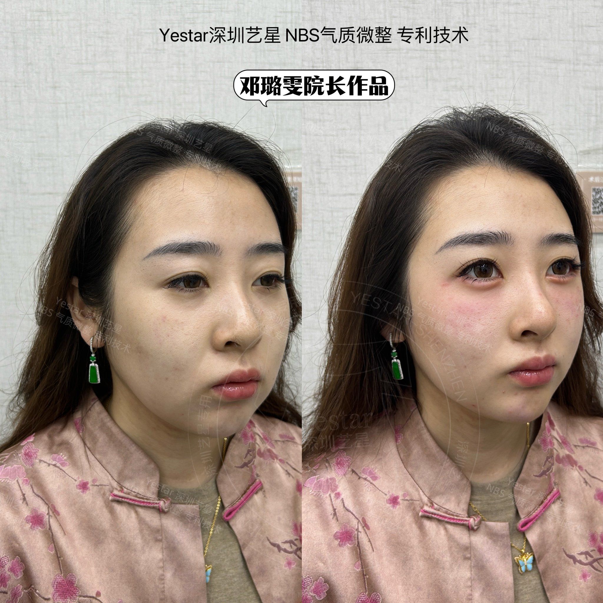 恋恋桃花眼👀🌸 面部内轮廓👩🏻‍