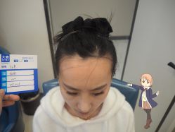 -大麦微针植发丨全国连锁