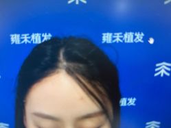 -雍禾植发全国连锁