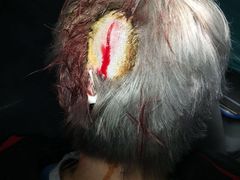 -天津市第三中心医院