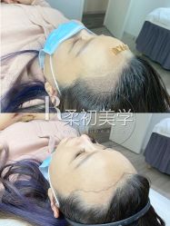 -RC半永久纹眉纹发际线