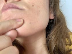 -SKINIST丽铂医疗美容