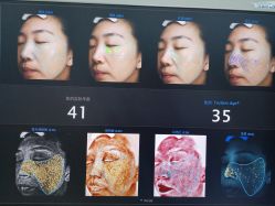 点击看大图 体验前-欧扬医疗美容