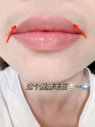 -小梨·OndaPro·专业脱毛连锁机构