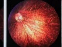 -西安普瑞眼科医院·近视手术·视力防控