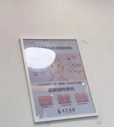 -瑶芳清颜草本祛痘