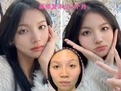 -北京米扬丽格医疗美容·联合丽格鼻整形中心