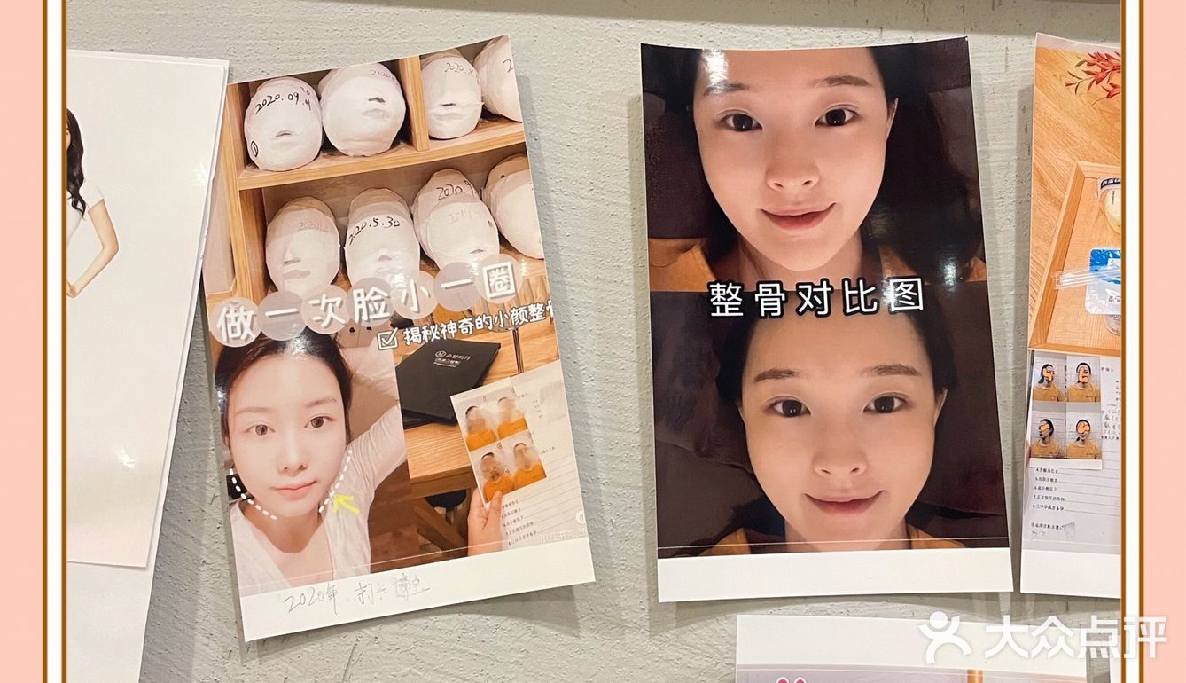 双井不可错过的小颜秘整骨