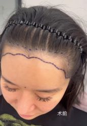 -熙朵美学植发·连锁品牌