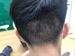 -雍禾植发全国连锁