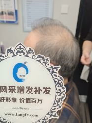 -唐风采假发补发定制