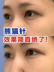 -繁星轻医美连锁