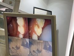 -赫尔森口腔·牙齿种植修复