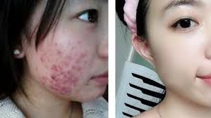 -SKINIST丽铂医疗美容
