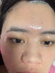 体验后-杭州奥拉克医疗美容门诊部