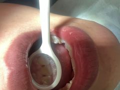 -宁波壹加壹口腔·矫正种植中心