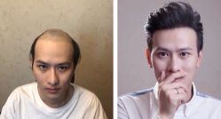 -发饰美男士增发补发假发定制店