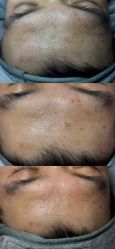 -skin79皮肤管理中心