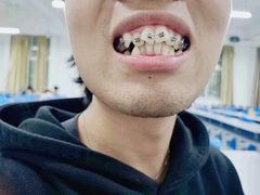 -极光口腔·矫正种植修复(锦江店)