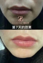 -杨益美学·野生眉半永久纹眉发际线