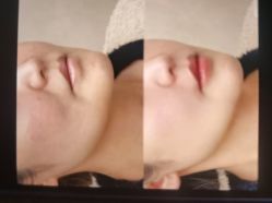 -苑苑vbeauty科技美容SPA