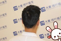 点击看大图 -大麦微针植发丨全国连锁