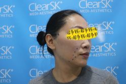 -洁铭新加坡医美