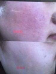 -苑苑vbeauty科技美容SPA