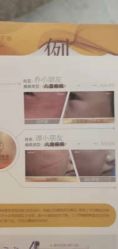 -正璞医疗美容·皮肤修复·微整注射