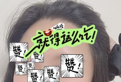 -大麦微针植发全国连锁