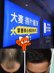 -大麦微针植发丨全国连锁