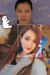 -深圳艺星医疗美容医院