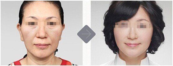 -CMS西美斯·美式医疗美容