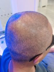 -雍禾植发全国连锁