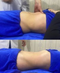 -蓝丝带产后恢复中心·催乳·通乳(渝北汽博店)