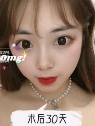 -天津健丽·去眼袋医疗美容机构