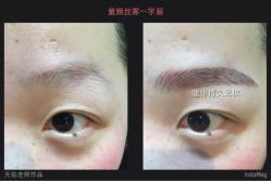 点击看大图 -光SPA科技美肤